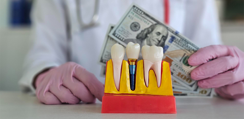 New Age Dental™ | Dental Implant Cost Melbourne: What Influences the Price?